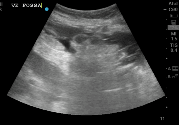 EEU case image missing